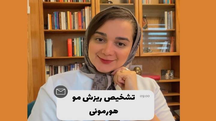 روش تشخیص ریزش مو هورمونی